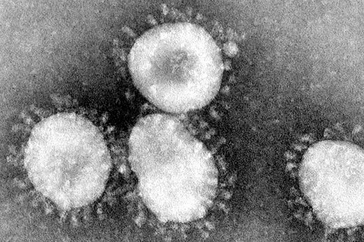 Grayscale image of coronaviruses