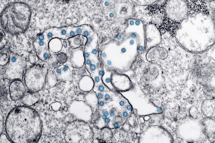 coronavirus particles in a slide