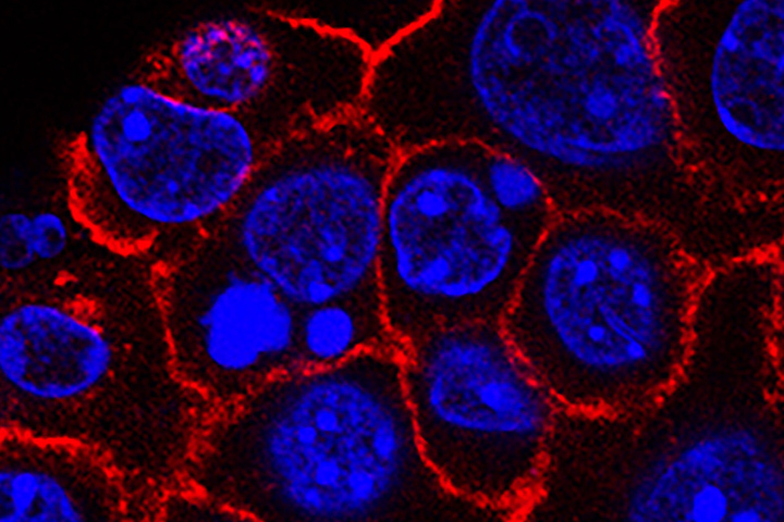 Microscope photo of pancreatic cancer cells (circular nuclei in blue) growing as a sphere encased in membranes (red edges around black cells).