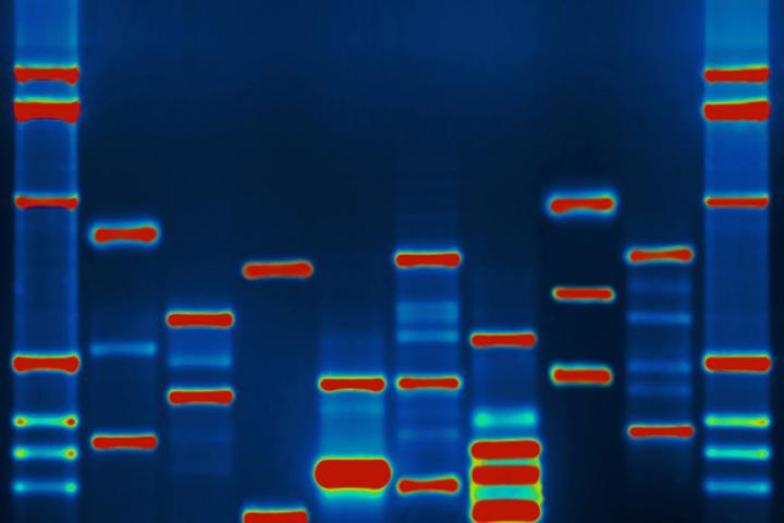 Image of DNA on a blue background showing blue columns of different lengths broken up by bands of red, green, aqua, and lighter blue.