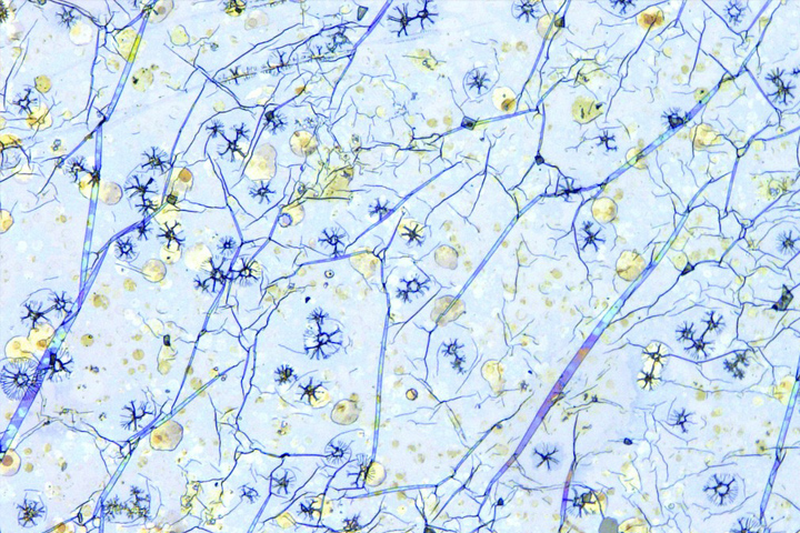 microscope slide that looks like plant stems and flowers that are darker blue or yellow on a light blue background