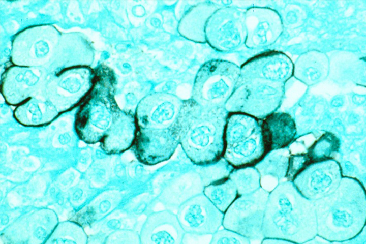 Magnified slide of human pancreas cells, stained in aqua color with a dark outline around some of the rounded cells