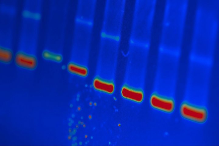 DNA analysis image with red, green and light blue bars in vertical columns, all in royal blue.