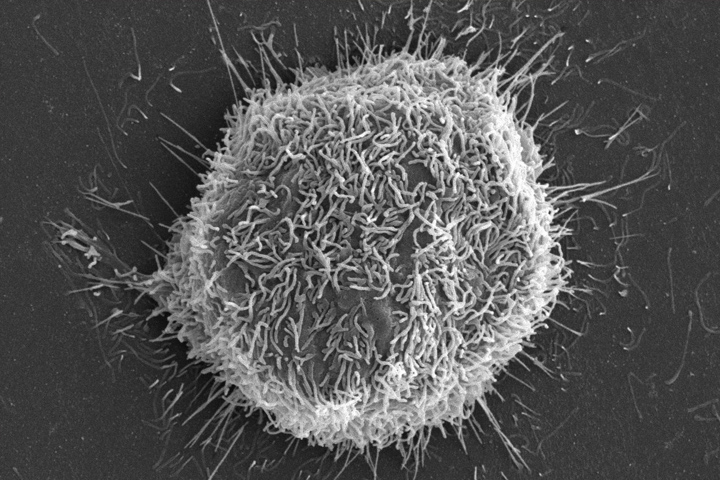 Black and white image of a cancer cell from under a microscope