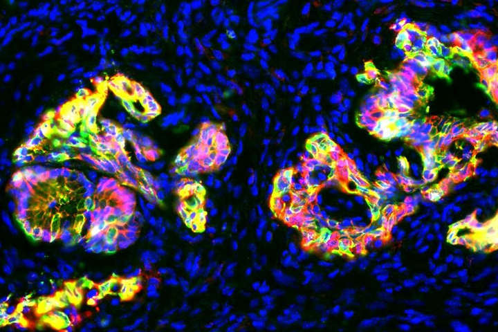 Precancerous pancreatic cells in mice