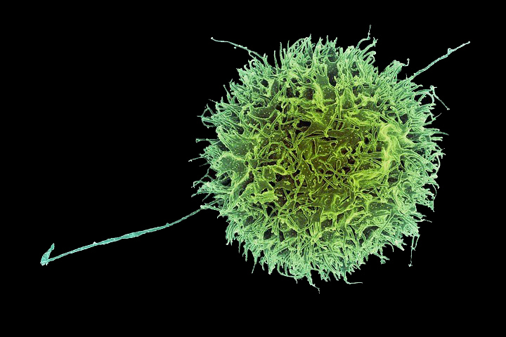 green human natural killer cell on a black background