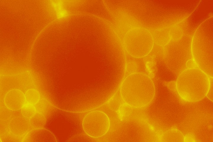 Microscope image of lipid bubbles