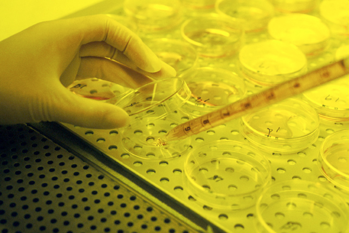 Hand of a lab worker opening a petri dish and putting liquid in with a pipette, in yellow lighting