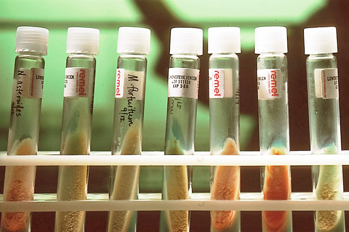 Seven test tubes in a rack, with orange or tan substances in the bottom halves, and white caps on top, against a green background