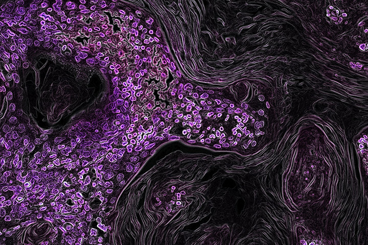 Mouse model of KRAS lung cancer in purple