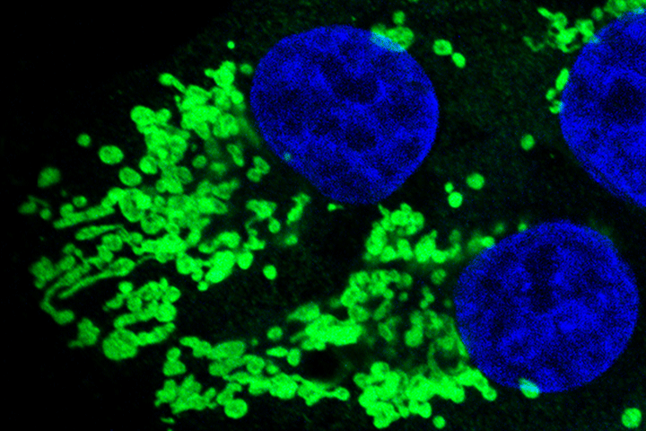 RAS mutated cancer cell