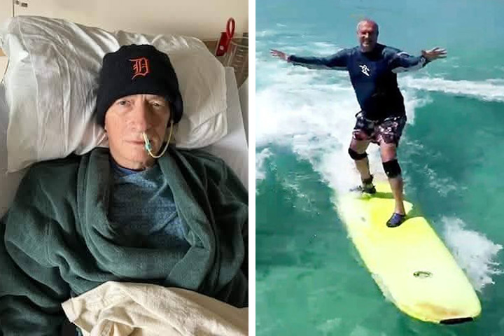 Jerry Chezick before and after